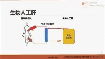 肝衰患者苦尽 肝 来 自主研发的首个生物人工肝产品获批临床